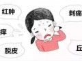护肤品过敏如何做